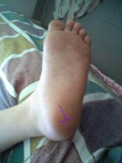 «ö¦¹¦b·sµøµ¡ÂsÄý¹Ï¤ù